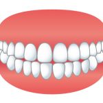 笑った時に歯ぐきがみえる人の７つの原因、３つの治療法。ガミースマイルの改善