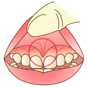 tongue015