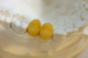 IMG_9525