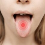 舌の汚れ（舌苔）を効率良く取る方法〜口臭予防や誤嚥性肺炎予防のために〜