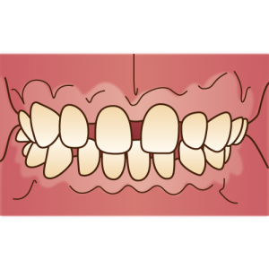orthodontics034